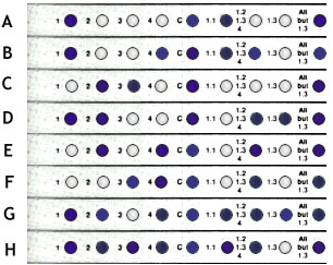 DQ Alpha DNA analysis